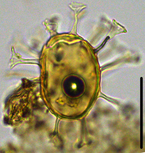 Hystrichosphaeridium tubiferum Helo27X23334360920b.jpg